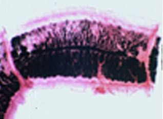 猪带绦虫孕节 c. 肌纤维 d. 植物细胞 e. 淀粉颗粒